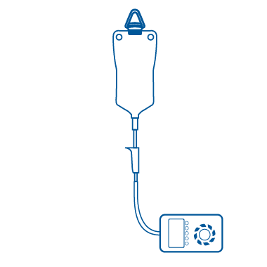 Set d'alimentation entérale type pompe Set d'alimentation entérale type pompe