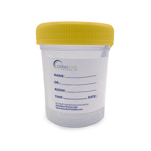 Coupe d'échantillon Urine (avant)