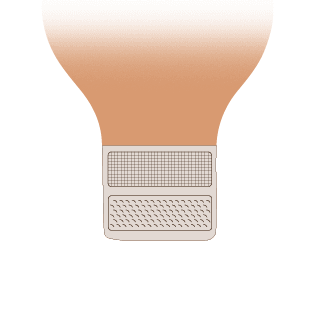 Bolsa de colostomía drenable con cierre de velcro