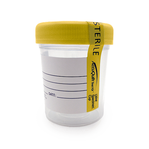 Coupe d'échantillon Urine (retour)
